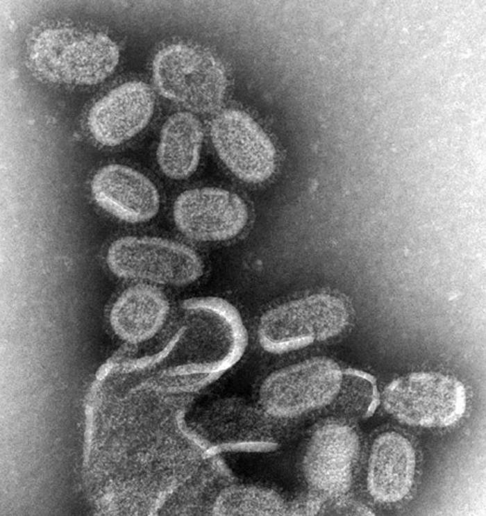 Electron microscope image of the H1N1 influenza virus