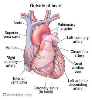 Coronary Artery Blockage Diagram